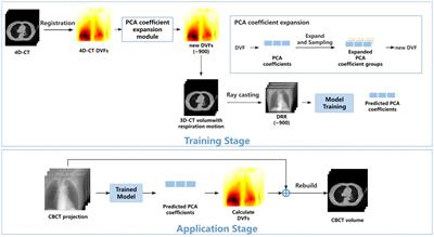 Spatiotemporal correlation enhanced real-time 4D-CBCT imaging using convolutional LSTM networks